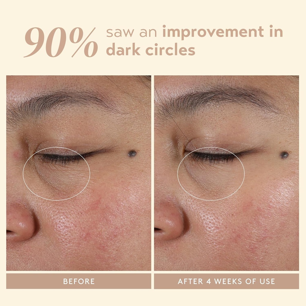 shani-darden-intensive-eye-renewal-cream-5.jpg