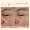 shani-darden-intensive-eye-renewal-cream-5.jpg