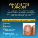 fungi-nail-anti-fungal-liquid-solution-1-4.jpg